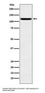 Anti-HAUSP / USP7 Rabbit Monoclonal Antibody