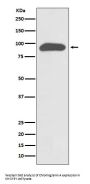 Anti-Chromogranin A CHGA Rabbit Monoclonal Antibody