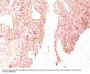 Anti-Chromogranin A / CHGA (Neuroendocrine Marker) Monoclonal Antibody