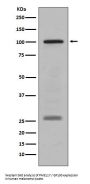 Anti-PMEL17 / GP100 Rabbit Monoclonal Antibody