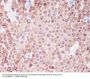 Anti-PMEL17 / GP100 Rabbit Monoclonal Antibody