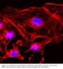 Anti-beta -Actin ACTB Rabbit Monoclonal Antibody, Clone#RM112