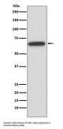 Anti-HNF1 beta Rabbit Monoclonal Antibody