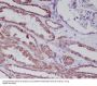Anti-Hsp60 HSPD1 Rabbit Monoclonal Antibody