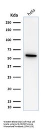 Anti-HSP60 (Heat Shock Protein 60) (Mitochondrial Marker) Monoclonal Antibody