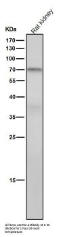 Anti-PKC theta Rabbit Monoclonal Antibody