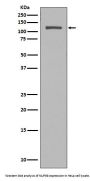 Anti-NUP98 Rabbit Monoclonal Antibody