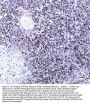 Anti-SATB1 Rabbit Monoclonal Antibody