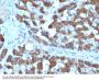 Anti-CPS1 / Carbamoyl-Phosphate Synthetase (Hepatocellular Marker) Monoclonal Antibody