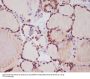 Anti-TTF1 NKX2-1 Rabbit Monoclonal Antibody