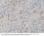Anti-TTF1 (Thyroid transcription factor 1) NKX2-1 Rabbit Monoclonal Antibody, Clone#RM373