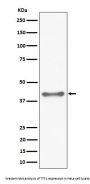 Anti-TTF1 Rabbit Monoclonal Antibody