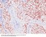 Anti-TTF-1 / NKX2.1 (Thyroid & Lung Epithelial Marker) Monoclonal Antibody