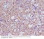 Anti-Neuropilin 1 NRP1 Rabbit Monoclonal Antibody