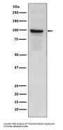 Anti-Thrombomodulin THBD Rabbit Monoclonal Antibody