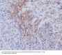 Anti-Thrombomodulin THBD Rabbit Monoclonal Antibody