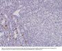 Anti-CD117/c-Kit Rabbit Monoclonal Antibody, Clone#RM359