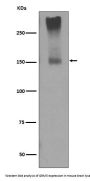 Anti-GRM5/Mglur5 Rabbit Monoclonal Antibody