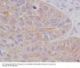 Anti-STAT2 Rabbit Monoclonal Antibody