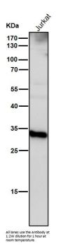 Anti-Cathepsin D CTSD Rabbit Monoclonal Antibody