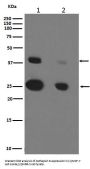 Anti-Cathepsin D CTSD Rabbit Monoclonal Antibody