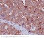 Anti-Cathepsin D CTSD Rabbit Monoclonal Antibody