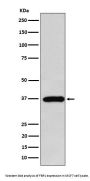 Anti-FBP1 Rabbit Monoclonal Antibody