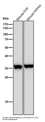 Anti-FBP1 Rabbit Monoclonal Antibody