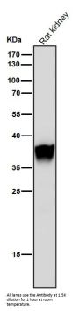 Anti-FBP1 Rabbit Monoclonal Antibody