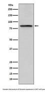 Anti-Periostin Monoclonal Antibody