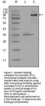 Anti-ER81 ETV1 Monoclonal Antibody