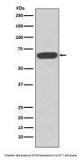 Anti-PKR EIF2AK2 Rabbit Monoclonal Antibody