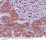 Anti-PKR EIF2AK2 Rabbit Monoclonal Antibody