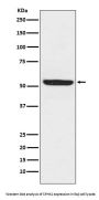 Anti-SPHK1 Monoclonal Antibody