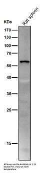 Anti-SPHK1 Monoclonal Antibody