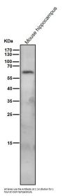 Anti-SPHK1 Monoclonal Antibody