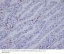 Anti-IBA1 AIF1 Monoclonal Antibody