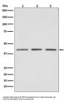 Anti-PRMT1 Rabbit Monoclonal Antibody