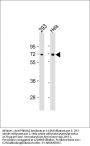 Anti-PRKAA2 Antibody