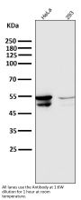 Anti-Cytokeratin 8 KRT8 Rabbit Monoclonal Antibody