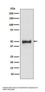 Anti-Cytokeratin 8 KRT8 Rabbit Monoclonal Antibody