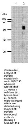 Anti-Perforin Prf1 Antibody (Monoclonal, CE2.10)