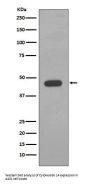 Anti-Cytokeratin 14 KRT14 Rabbit Monoclonal Antibody