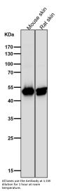 Anti-Cytokeratin 14 KRT14 Rabbit Monoclonal Antibody