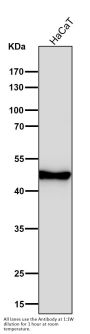 Anti-Cytokeratin 14 KRT14 Rabbit Monoclonal Antibody