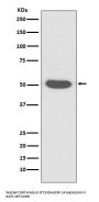 Anti-Cytokeratin 14 KRT14 Rabbit Monoclonal Antibody