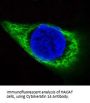 Anti-Cytokeratin 14 KRT14 Rabbit Monoclonal Antibody