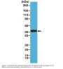 Anti-CK-14 (Cytokeratin-14) KRT14 Rabbit Monoclonal Antibody, Clone#RM328