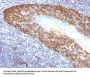 Anti-Cytokeratin 14 (KRT14) (Squamous Cell Marker) Monoclonal Antibody