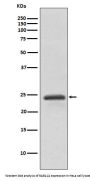 Anti-RAB11A Rabbit Monoclonal Antibody